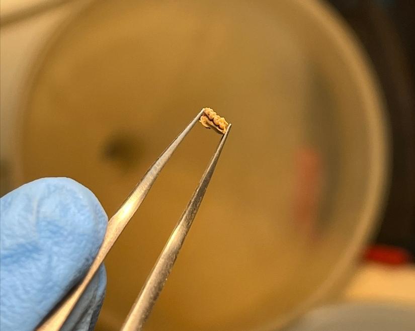 Very small set of teeth held in tweezers